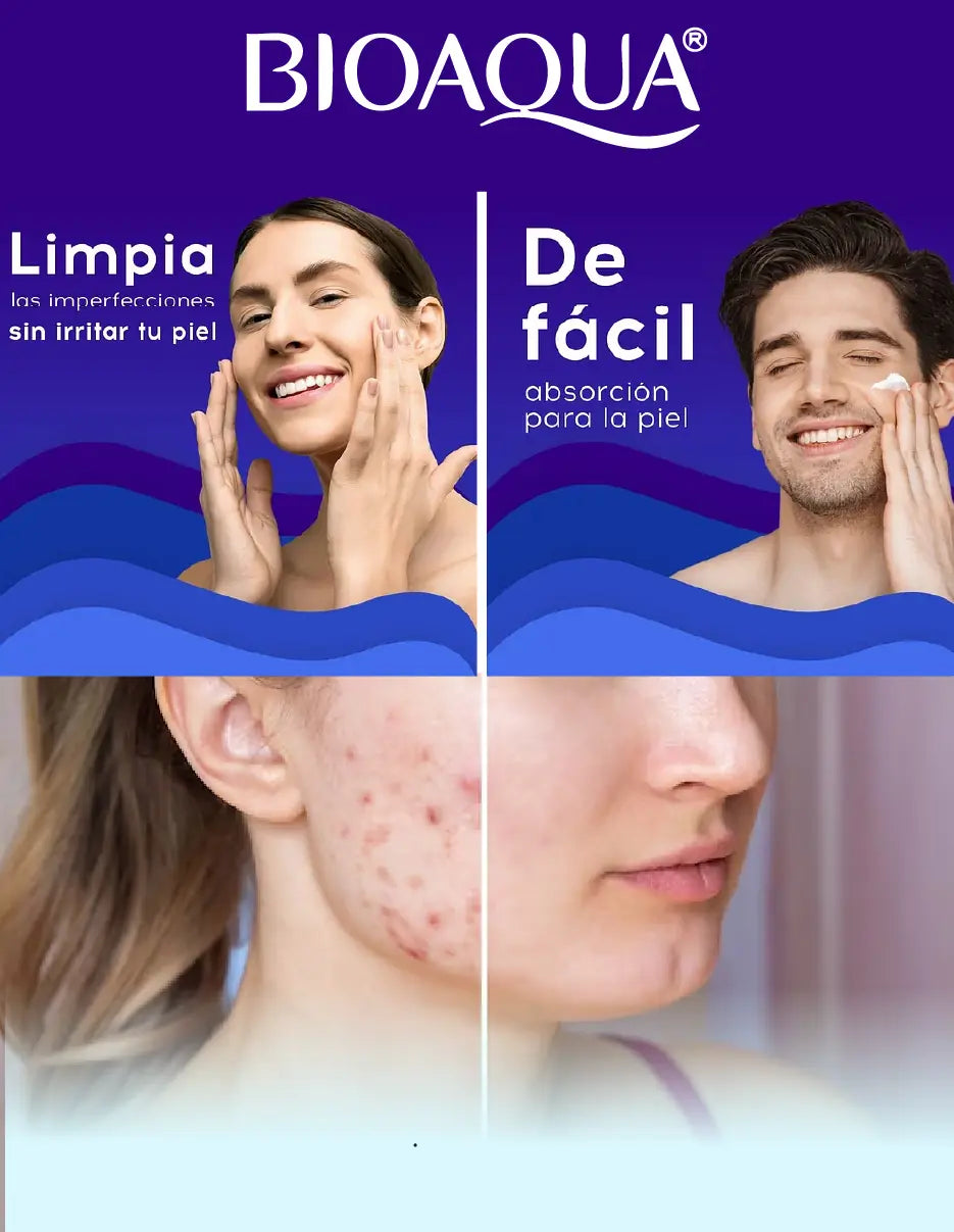 CREMA ANTI ACNE BIOAQUA