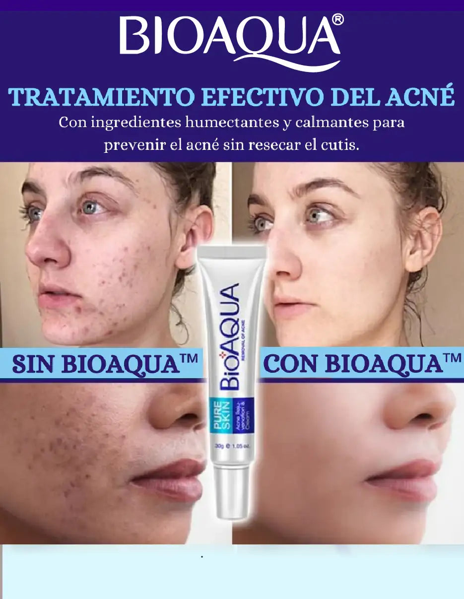 CREMA ANTI ACNE BIOAQUA