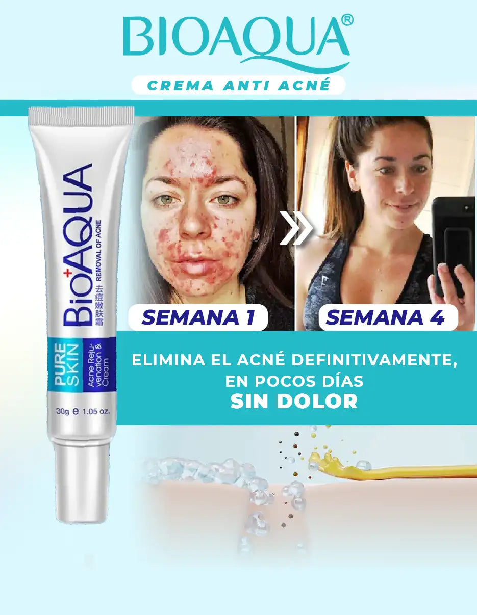 CREMA ANTI ACNE BIOAQUA