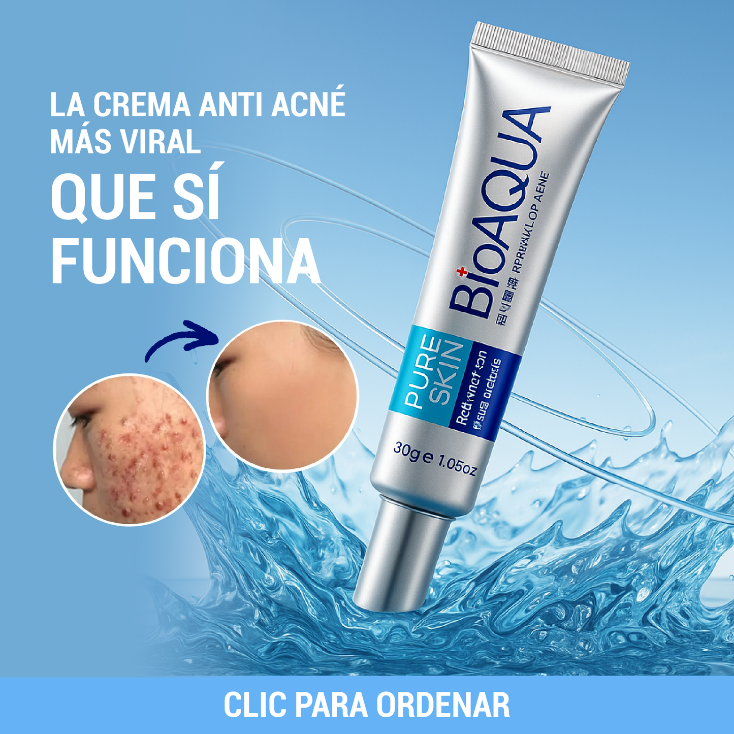 CREMA ANTI ACNE BIOAQUA